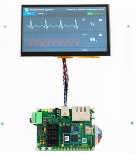 LVGL Medizinanwendung mit OSM Modul und NXP i.MX 93